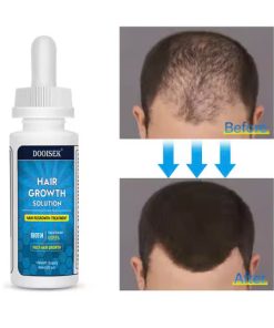 Huyết thanh mọc tóc Biotin dầu cho tóc - Xịt chống rụng tóc